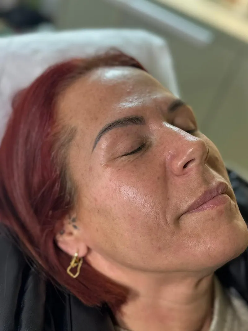 Solarium Point Laser Clinic - Tattoo and Hair removal